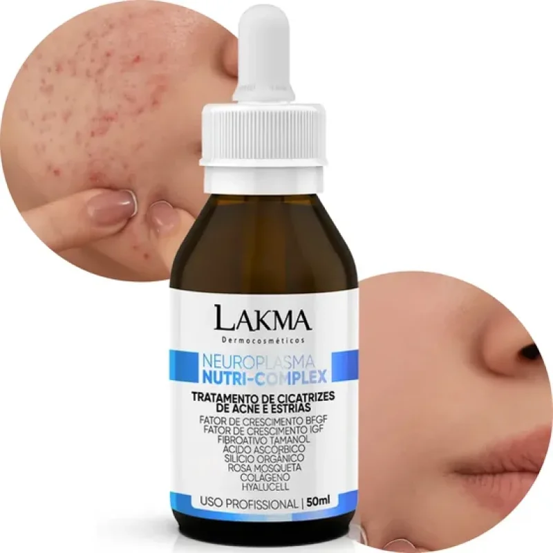 Lakma Neuroplasma Nutri Complex 50ml Cicatriz Acne estrias Tipo de pele Normal
